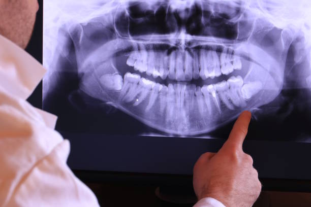 Best Emergency Dental Surgery in Farr West, UT