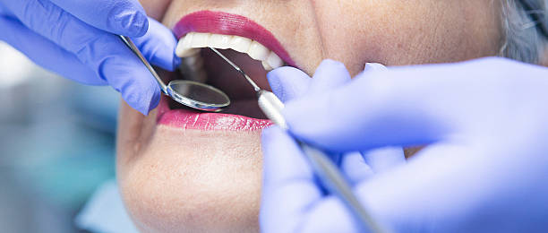 Best Emergency Wisdom Teeth Removal in Farr West, UT